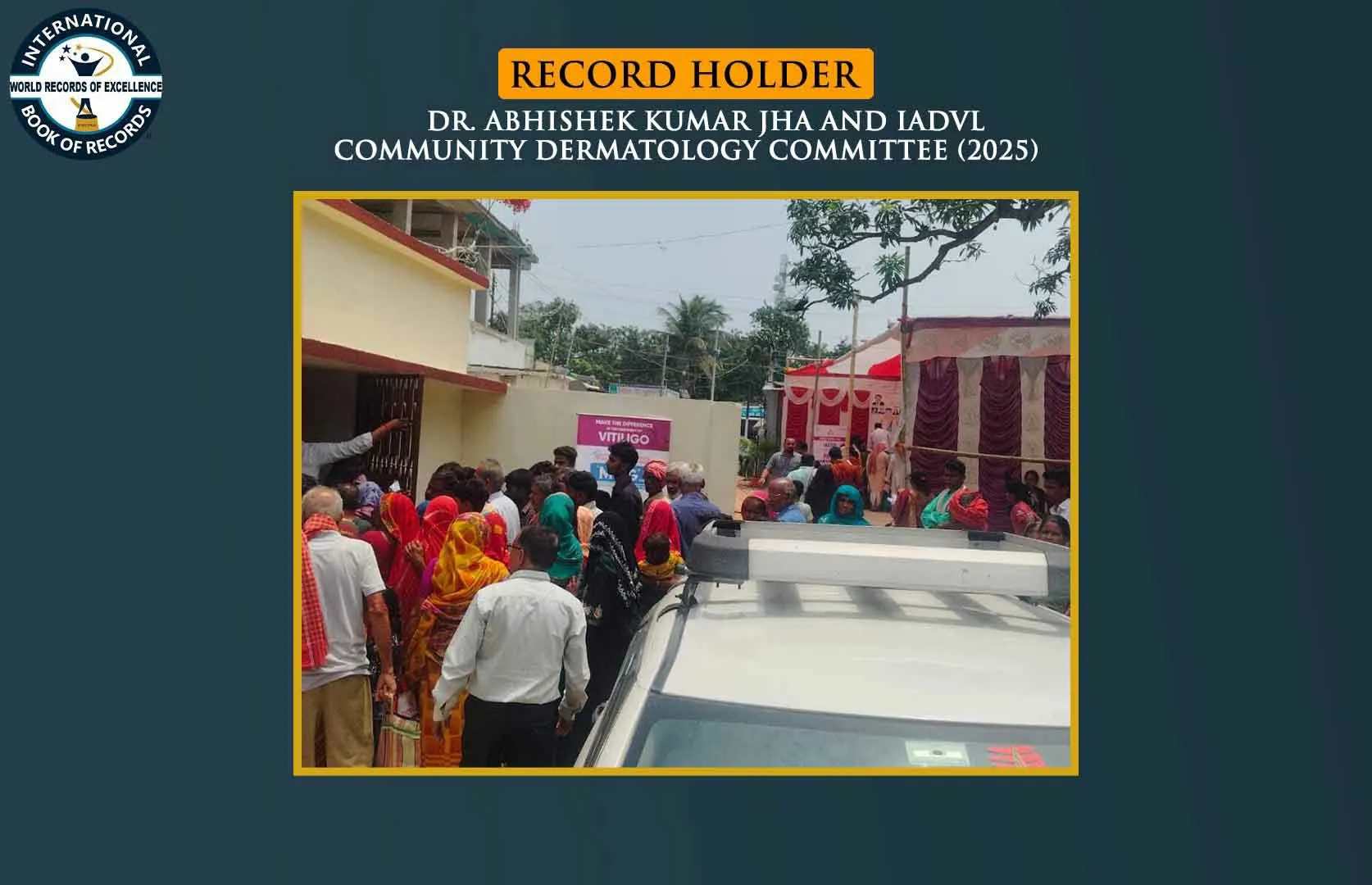 MAXIMUM NUMBER OF FREE VITILIGO SURGERIES PERFORMED IN ONE DAY (MASS)