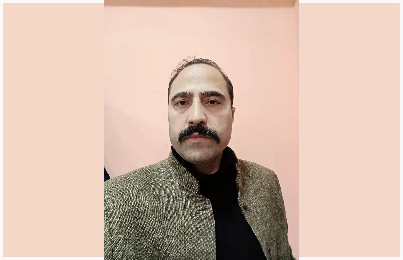 LONGEST APPENDIX REMOVED