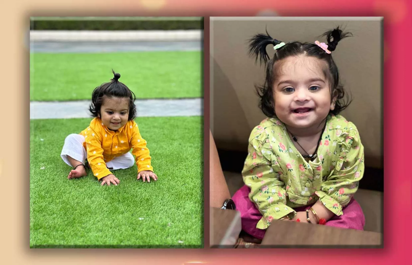 LONGEST CONGENITAL HAIR (INFANT)