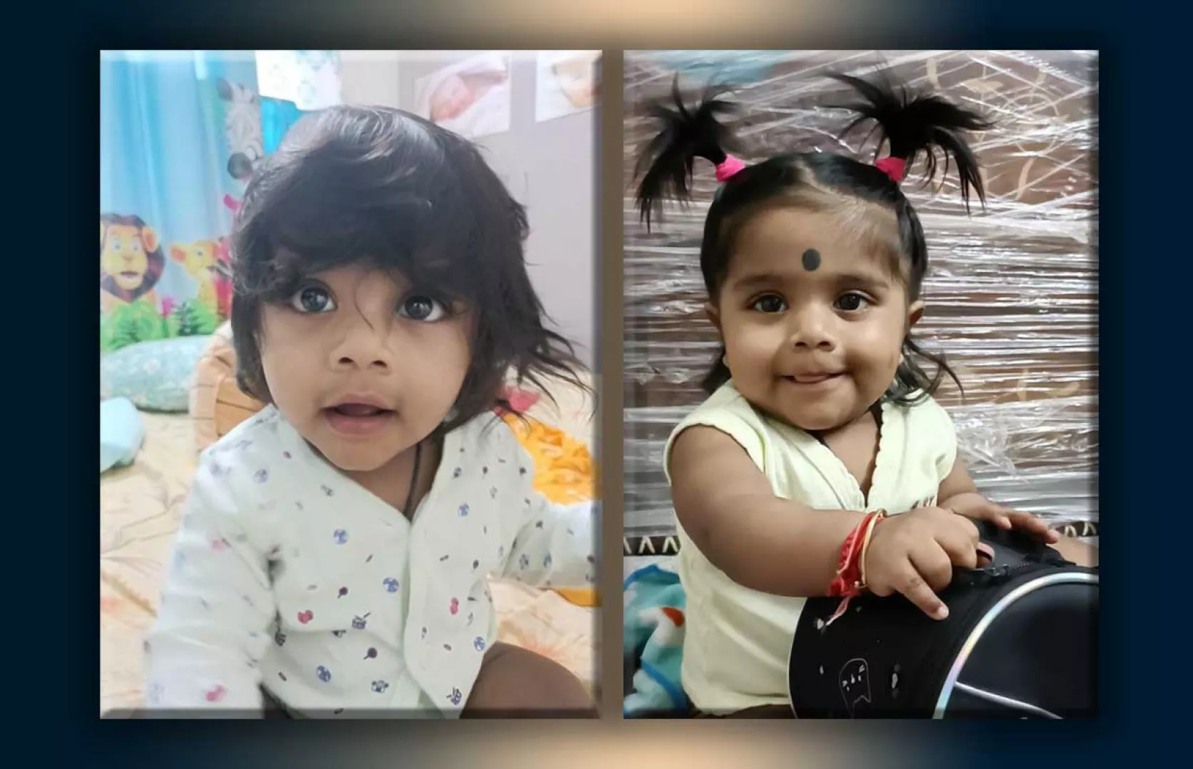 LONGEST CONGENITAL HAIR (INFANT)