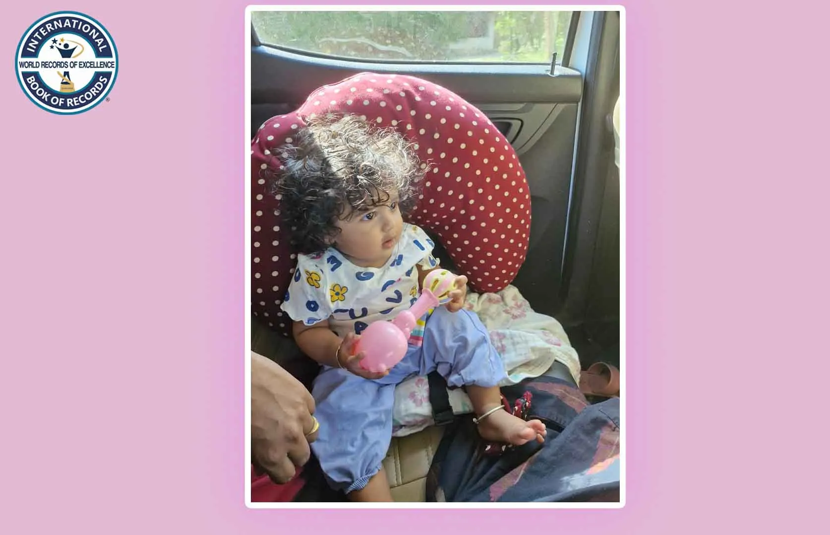 LONGEST CONGENITAL HAIR (INFANT)